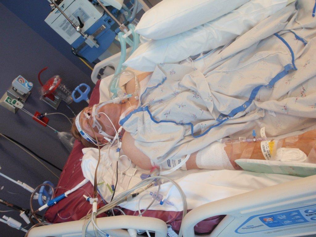 hospital 12 tubes in 10 tubes out