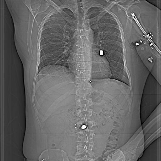 x ray body cavity with left humurus clear image