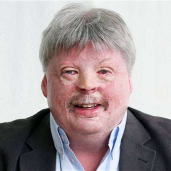 Simon Weston