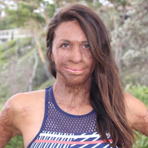 Turia Pitt